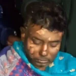 ডামুড্যায় কুপিয়ে ও শরীরে আগুন দেওয়ার ঘটনায় ব্যবসায়ী খোকনের মৃত্যু