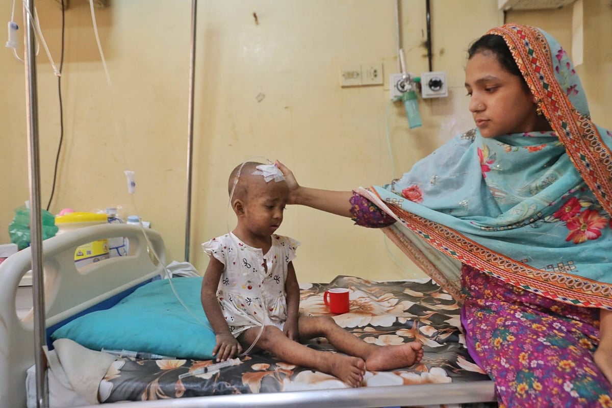 4 more children died with measles symptoms in 24 hours