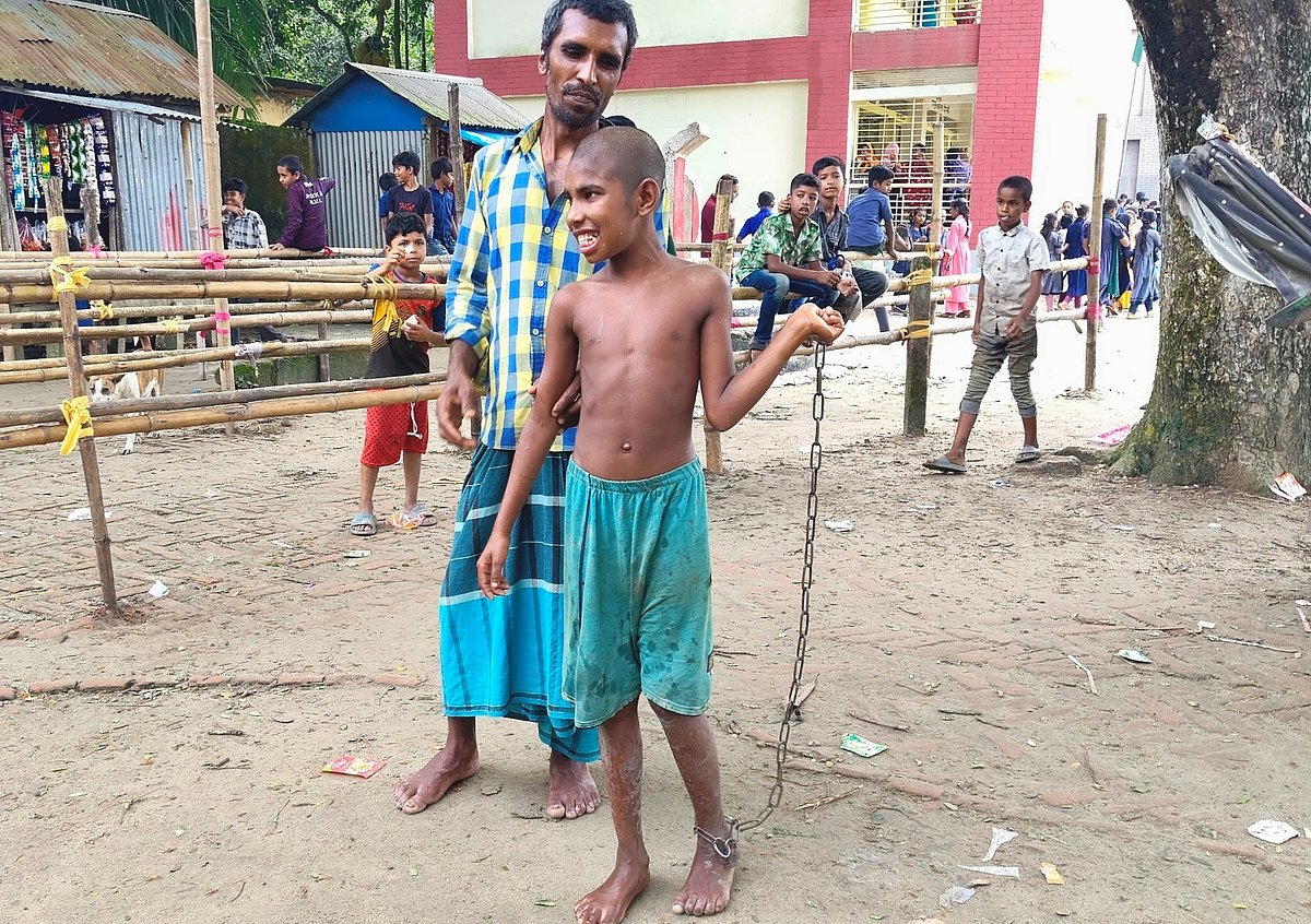The life of chained child Rifat is not being treated financially