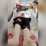 After being beaten, he was thrown from the fifth floor and suffered broken arms, legs, chest and back bones