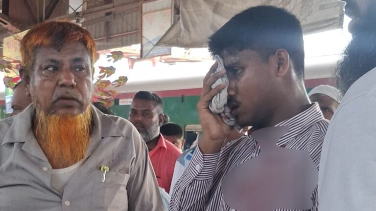সিরাজগঞ্জে চলন্ত ট্রেনে পাথর নিক্ষেপে দৃষ্টিশক্তি হারালেন শিক্ষার্থী
