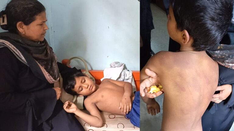 মুকসুদপুরে মাদ্রাসার শিশু শিক্ষার্থীকে পিটিয়ে আহত করার অভিযোগে শিক্ষক আটক