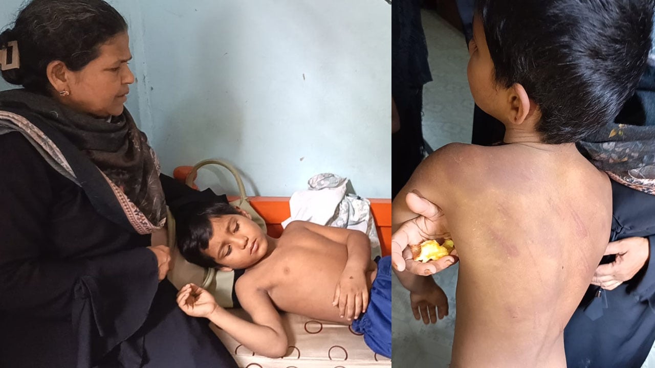 মুকসুদপুরে মাদ্রাসার শিশু শিক্ষার্থীকে পিটিয়ে আহত করার অভিযোগে শিক্ষক আটক