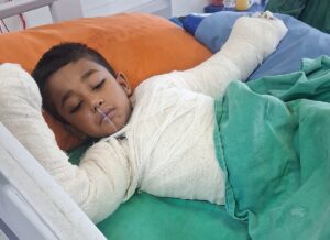 Five-Year-Old Boy Loses Arm After Transformer Sparks Near Residential Balcony in Gazipur