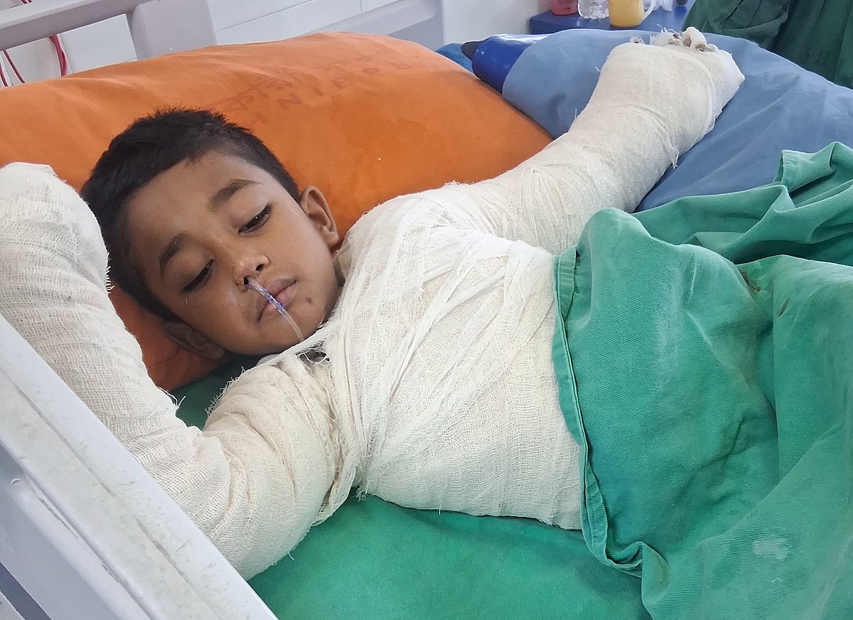 Five-Year-Old Boy Loses Arm After Transformer Sparks Near Residential Balcony in Gazipur