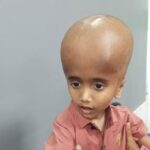 Five Year Old Kurigram Boy Battles Hydrocephalus as Family Appeals for Medical Aid