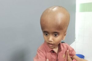 Five Year Old Kurigram Boy Battles Hydrocephalus as Family Appeals for Medical Aid