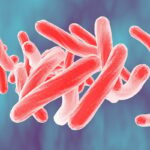 Eleven Patients Contract Tuberculosis Following Surgery at Pabna Private Hospital