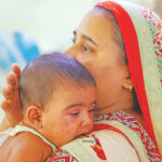 Six-Month-Old Infant Battles Concurrent Dengue and Measles Infection at Dhaka Children Hospital