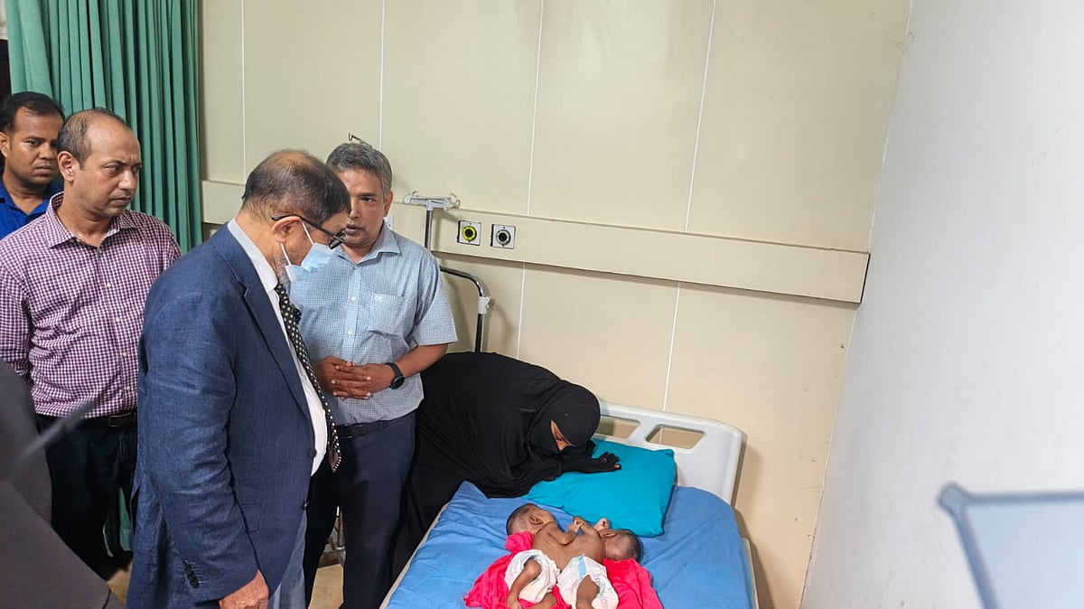 Government to Bear Full Treatment Costs for Conjoined Twins at Dhaka Medical College Hospital
