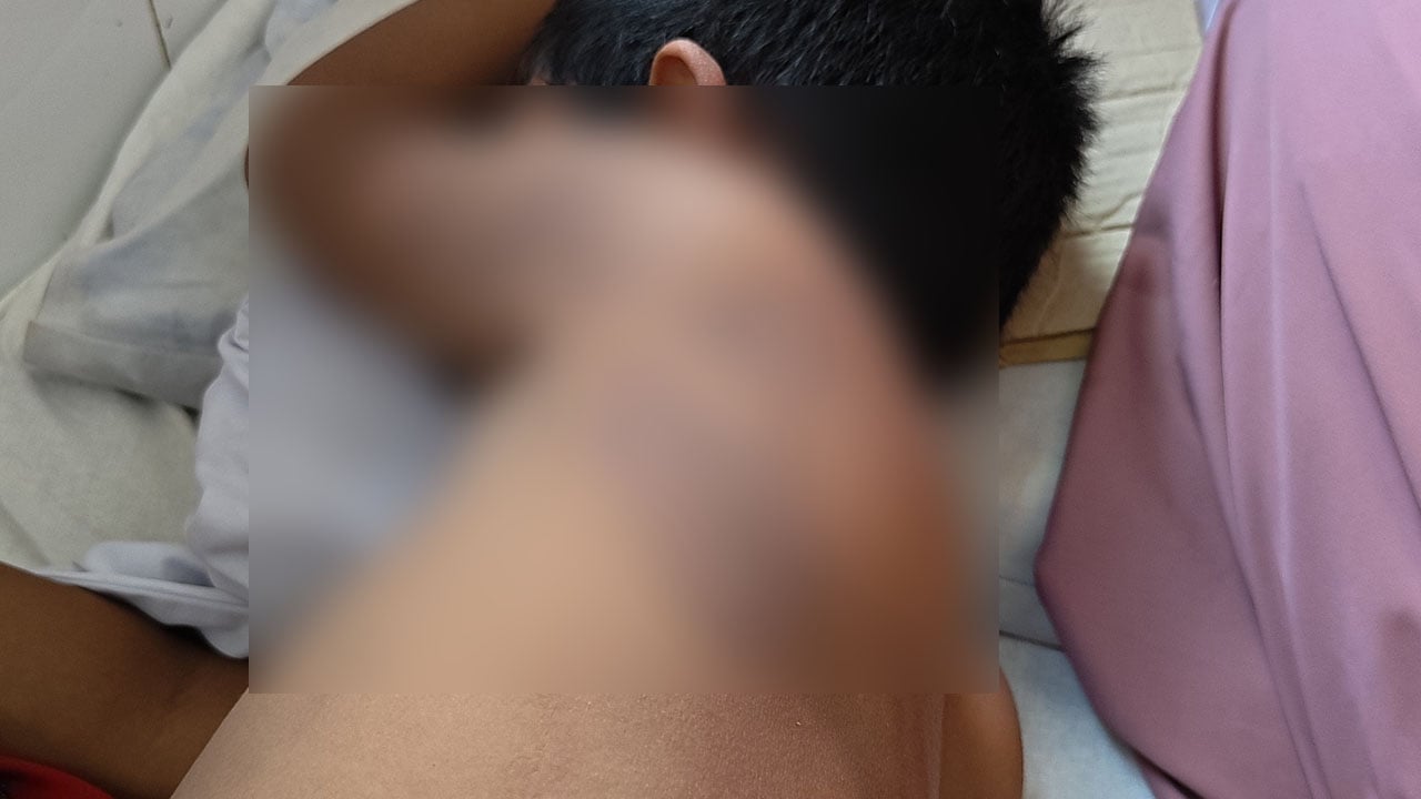 শরণখোলায় মাদ্রাসার ছাত্রকে পিটিয়ে আহত করার অভিযোগে শিক্ষকের বিরুদ্ধে মামলা