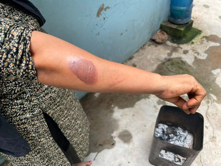 Severe Gas Shortages Force Dhaka Residents to Rely on Wood Stoves and Expensive Alternatives